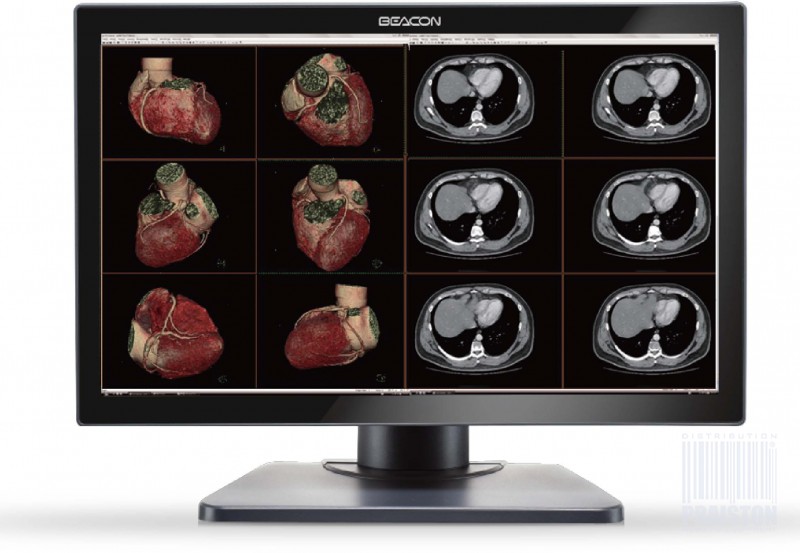 Monitory medyczne BEACON C44W+