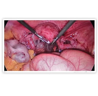 Monitory medyczne Eizo CuratOR EX4342-3D