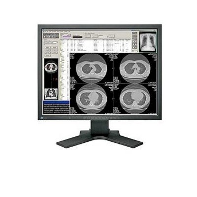 Monitory medyczne Eizo FlexScan MX210