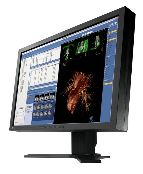 Monitory medyczne Eizo FlexScan MX240W