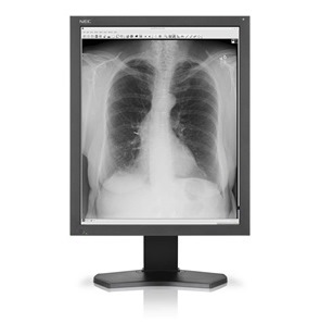 Monitory medyczne NEC MD212G3