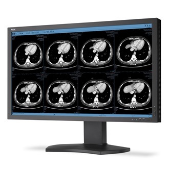 Monitory medyczne NEC MD322C8