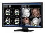 Monitory medyczne NEC MDview 231