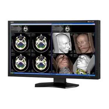 Monitory medyczne NEC MDview 272