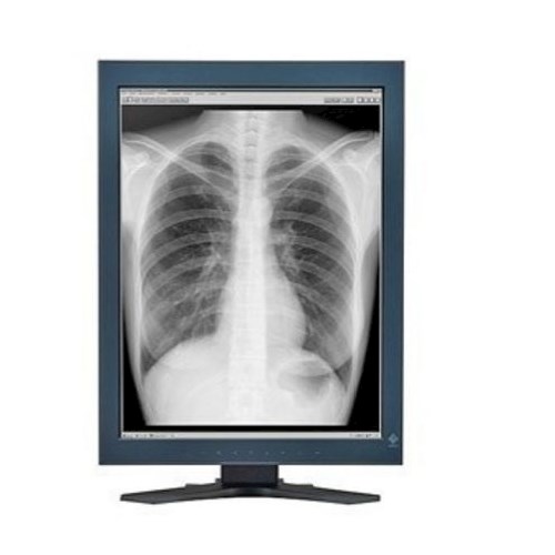 Monitory medyczne Eizo RadiForce GS521