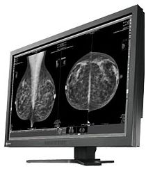 Monitory medyczne Eizo RadiForce GX1030
