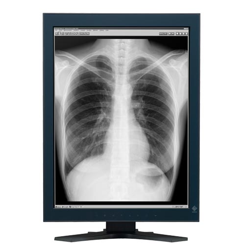 Monitory medyczne Eizo RadiForce GX320