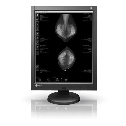 Monitory medyczne Eizo RadiForce GX540