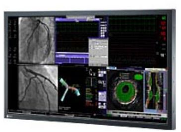 Monitory medyczne Eizo RadiForce LS560W