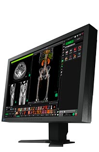 Monitory medyczne Eizo RadiForce MX241W