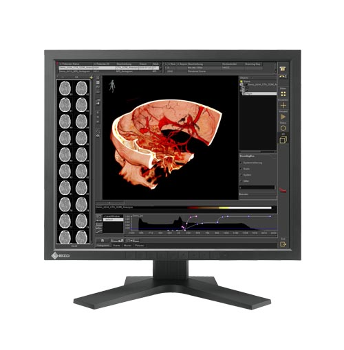 Monitory medyczne Eizo RadiForce RS110
