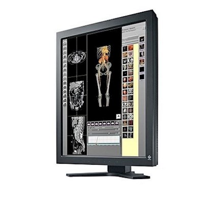 Monitory medyczne Eizo RadiForce RS210