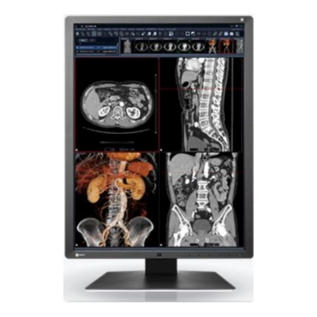 Monitory medyczne Eizo RadiForce RX250
