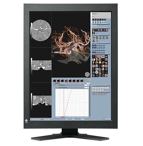 Monitory medyczne Eizo RadiForce RX320