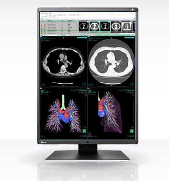 Monitory medyczne Eizo RadiForce RX360