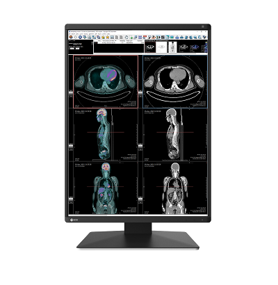 Monitory medyczne Eizo RadiForce RX370