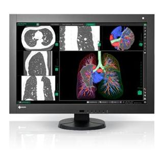 Monitory medyczne Eizo RadiForce RX440