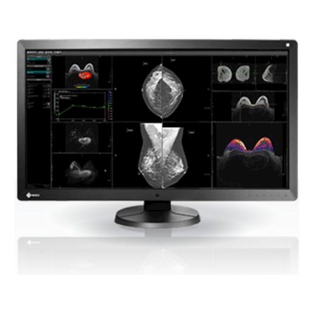 Monitory medyczne Eizo RadiForce RX850