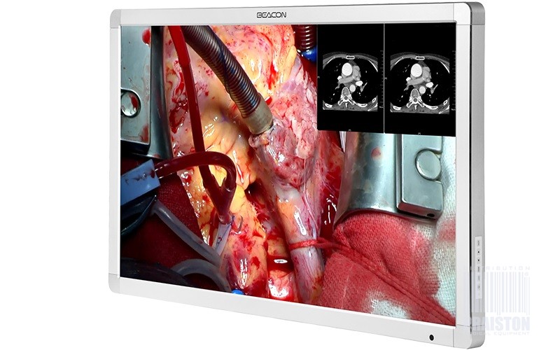 Monitory medyczne BEACON S272P