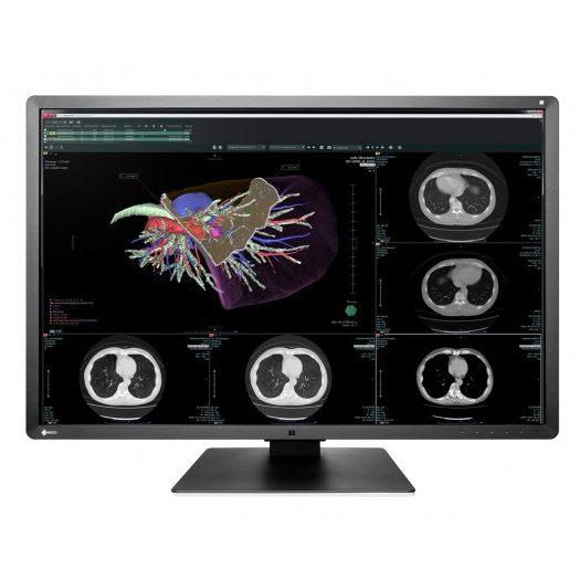 Monitory medyczne używane B/D Eizo RadiForce RX660 - Praiston rekondycjonowany