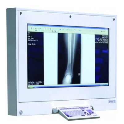 Negatoskopy cyfrowe na salę operacyjną ULTRAVIOL DICO 1M 49"