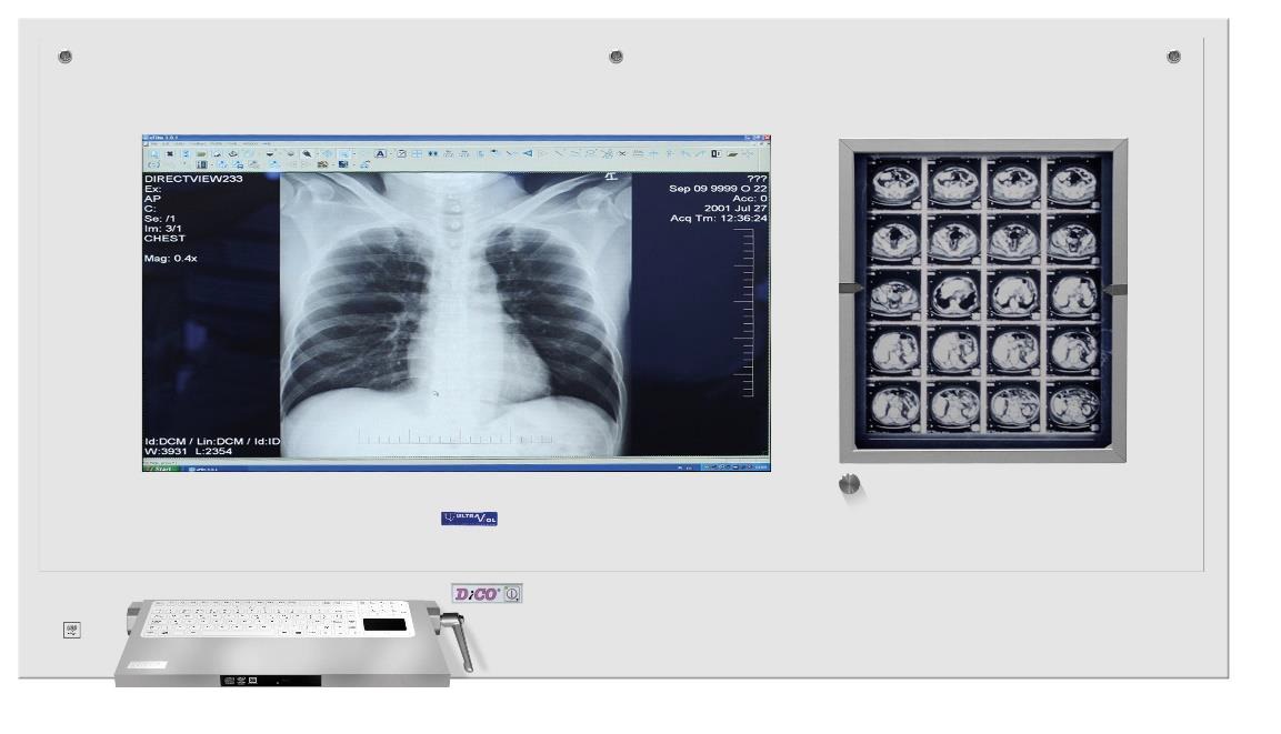 Negatoskopy cyfrowe na salę operacyjną ULTRAVIOL DICO 1M/1B 21" NEGATOSKOP RZEGLĄDOWY CYFROWYCH OBRAZÓW MED.