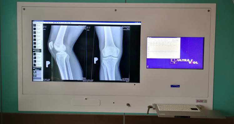 Negatoskopy cyfrowe na salę operacyjną ULTRAVIOL DICO 2M 49"/24" NEGATOSKOP PRZEGLĄDOWY CYFROWYCH OBRAZÓW MED.