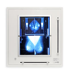 Negatoskopy mammograficzne ULTRAVIOL NGP-21 mZ