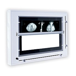 Negatoskopy mammograficzne ULTRAVIOL NGP-31 mZU