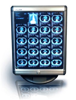 Negatoskopy SLIM LED Jejoong Medical Dilos-100D