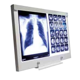 Negatoskopy SLIM LED Rego X-Ray GmbH X-ray Viewing Boxes