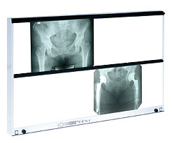 Negatoskopy wysokiej częstotliwości ULTRAVIOL NGP-600 HF/NGP-600 R HF