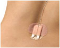 Opatrunki mocujące (cewnik, dren, kaniula) Copenhagen Medlab Epi-Guard