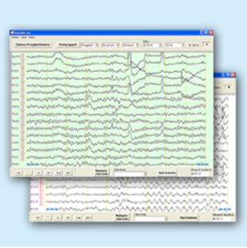 Oprogramowanie do analizy EEG ASPEL AsTEK EEG 3M Alfa System v.001