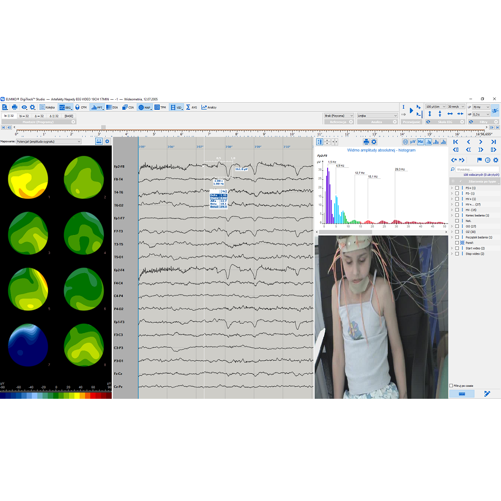 Oprogramowanie do analizy EEG ELMIKO do analizy EEG