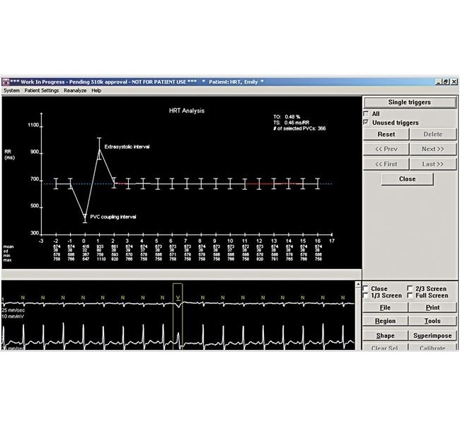 Oprogramowanie do Aparatów EKG GE Healthcare Analiza turbulencji rytmu serca (HRT)