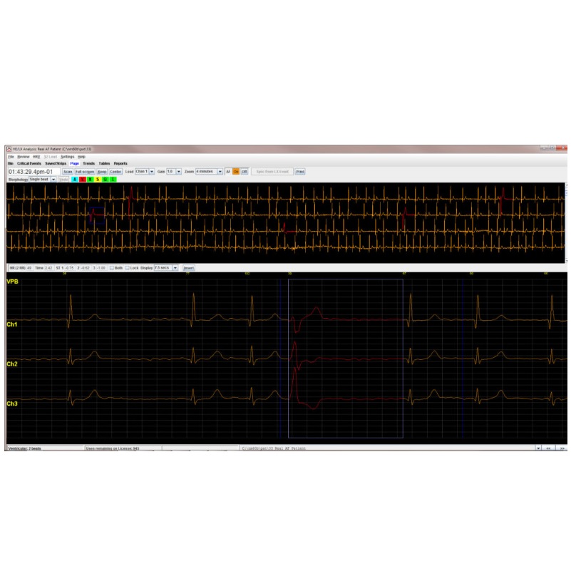 Oprogramowanie do Aparatów EKG NorthEast Monitoring HE/LX® Analysis