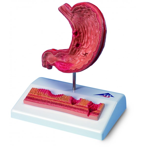 Organy i narządy 3B Scientific K17