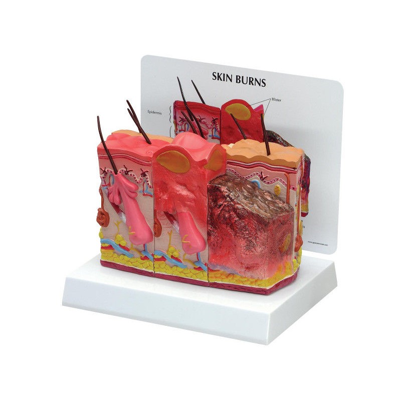 Organy i narządy 3B Scientific W33372