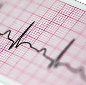 Papiery do EKG – rolki ASPEL Papier EKG