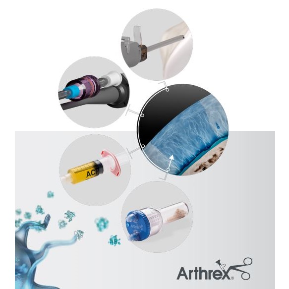 Preparaty do regeneracji chrząstki stawowej do artroskopii ARTHREX AutoCart
