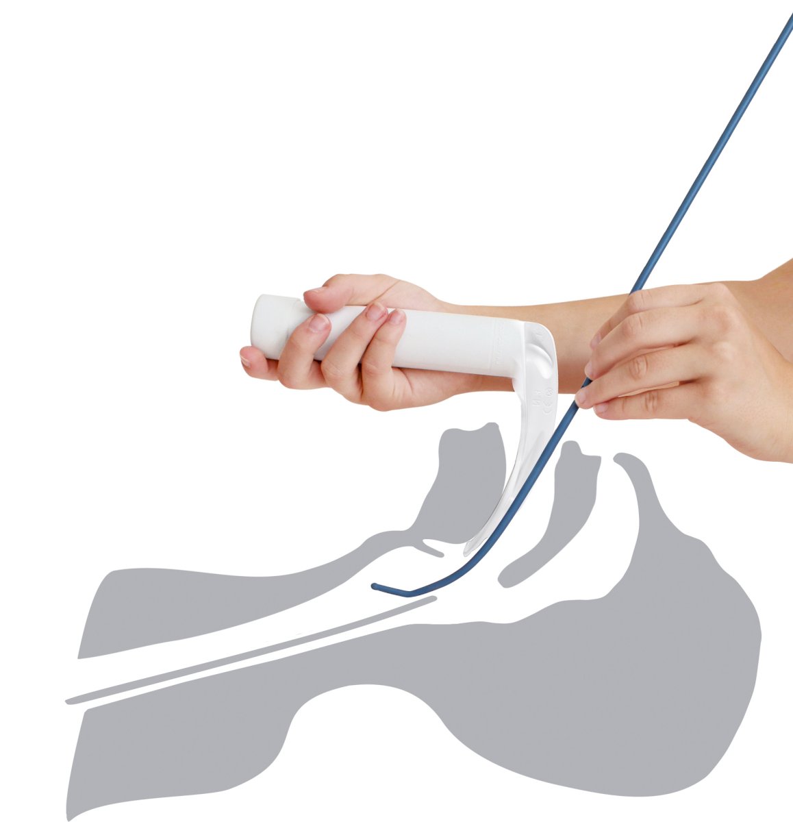 Prowadnice do trudnych intubacji VBM Medizintechnik 33-80-650-1