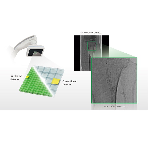 RTG do angiografii obwodowej Canon Alphenix SKY+