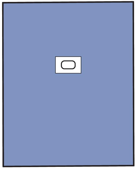 Serwety operacyjne – obłożenie pola operacyjnego OneMed 1530-01