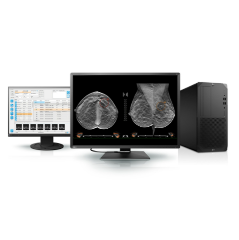 Stacje diagnostyczne obrazów medycznych Alstor mammograficzna