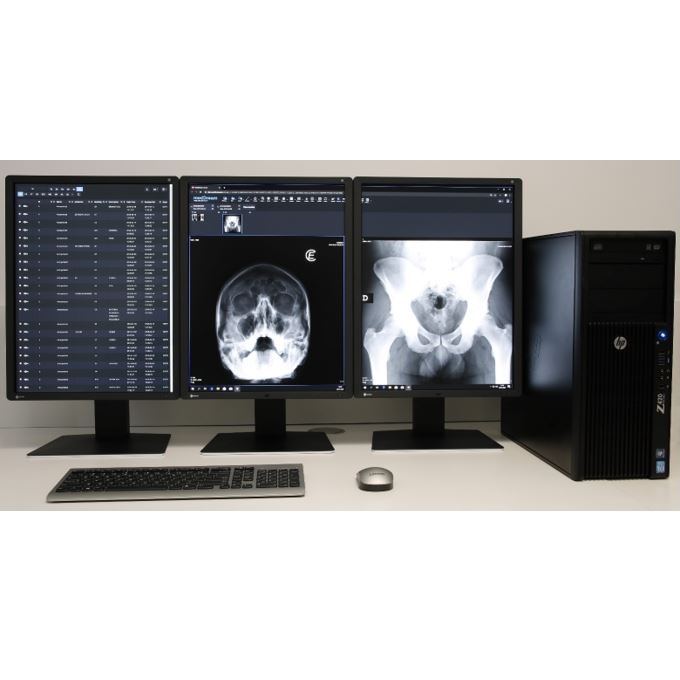 Stacje diagnostyczne obrazów medycznych IT4KAN Stacja opisowa dla lekarza radiologa