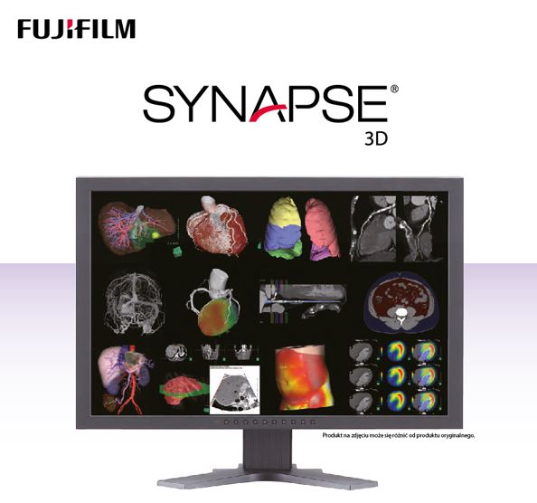 Stacje diagnostyczne obrazów medycznych FUJIFILM SYNAPSE 3D