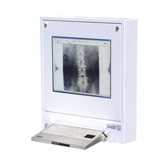 Stacje przeglądowe obrazów medycznych na sale operacyjne ULTRAVIOL DICO 1M 21" - STACJA PRZEGLĄDOWA CYFROWYCH OBRAZÓW MEDYCZNYCH