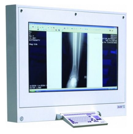 Stacje przeglądowe obrazów medycznych na sale operacyjne ULTRAVIOL DICO 1M 49" -  STACJA PRZEGLĄDOWA CYFROWYCH OBRAZÓW MEDYCZNYCH