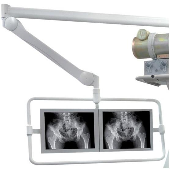 Stoły rentgenodiagnostyczne Primax UROMAT DFD